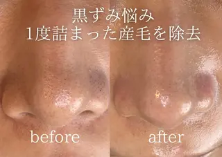 Peerless所属・chi kaのエステ・リラクイメージ