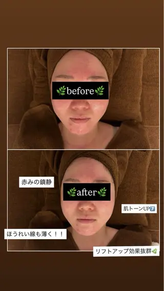 23beauty所属・武藤 那月のエステ・リラクイメージ