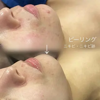 salon 398所属・salon 398 Kyokoのマツエク・マツパデザイン