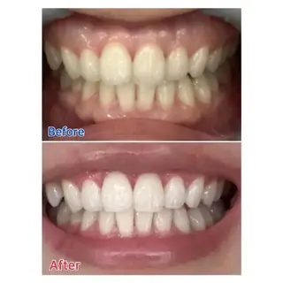 M渋谷店所属・M渋谷 ホワイトニングのエステ・リラクイメージ