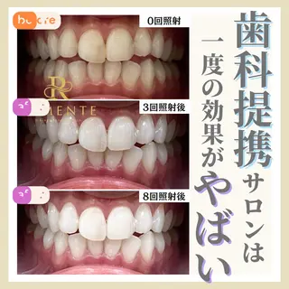 天神ホワイトニングスタジオ所属・天神ホワイトニング スタジオ大名店のその他イメージ