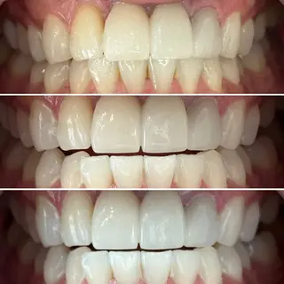 whitening salon yatto.所属・ホワイトニングサロン yatto.のその他イメージ