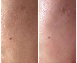 First Star所属・First Star あきの眉毛・アイブロウイメージ