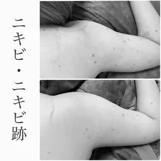 BeSkin藤沢店所属・ニキビ/肌質改善 BeSkin 藤沢店のエステ・リラクイメージ