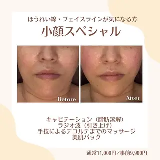 pushup 、のエステ・リラクイメージ