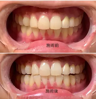 整体フェイシャル EMINALのエステ・リラクイメージ