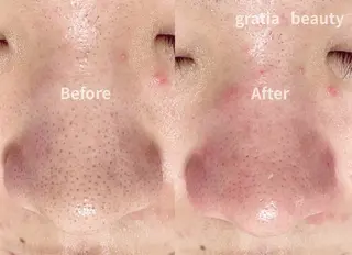 gratia  eyelash&nail所属・gratia salonのその他イメージ