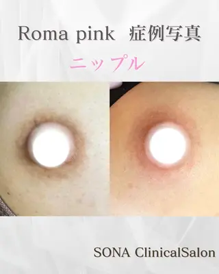 小顔/たるみ/黒ずみ除去専門サロン/SONA 大和西大寺店所属・【小顔専門看護師 サロンSONA】のエステ・リラクイメージ