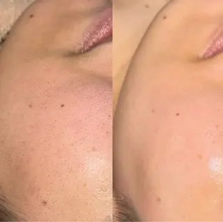 ツキイチ肌管理 ivy careのエステ・リラクイメージ