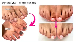 ネイル 深爪矯正専門店ネイルサロンKUU所属・深爪矯正専門店 ネイルサロンKUUのネイルデザイン