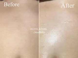 HOTEL&PARK . ワックス脱毛のエステ・リラクイメージ
