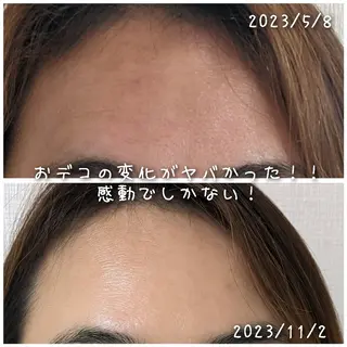 結果が出るスキンケア 肌質改善/まつパのエステ・リラクイメージ