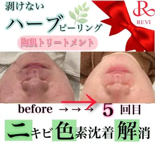 laluna saki...のその他イメージ