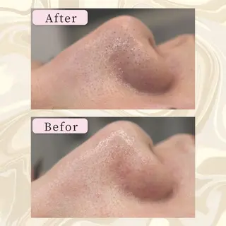 ANRIRE (アンリール)のエステ・リラクイメージ