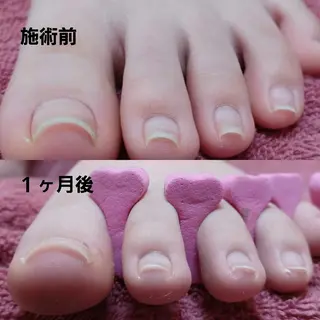 ネイル Micky nail chikushinoのその他イメージ