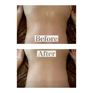 mooi【モーイ】所属・【北堀江】 痩身/小顔　mooiのエステ・リラクイメージ