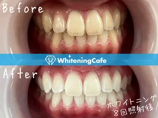 ホワイトニングカフェ徳島沖浜店所属・ホワイトニングカフェ 徳島沖浜店のエステ・リラクイメージ