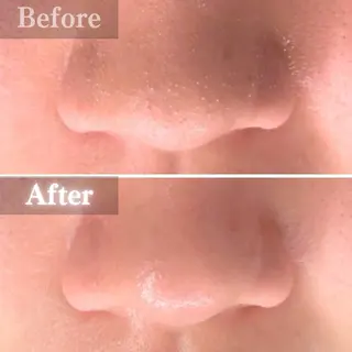 毛穴洗浄特化🫧 オオツカのエステ・リラクイメージ