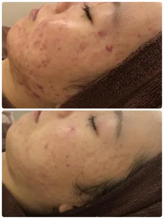 ミディアム カラー パーマ ヘアアレンジ メンズ キッズ ネイル マツエク・マツパ ニキビ・肌質改善専門 ♡人生が変わるサロンのエステ・リラクイメージ