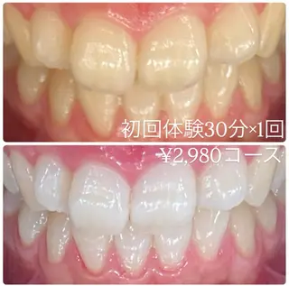 PLATINUM Beauty 横浜店所属・ホワイトニングルーム 横浜店のその他イメージ