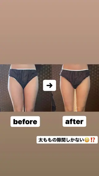 ネイル マツエク・マツパ アイブロウ 代表  山下 智景のエステ・リラクイメージ