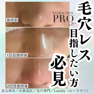 Luralïy hair kitakyushu所属・Luralïy ルーラリーのエステ・リラクイメージ