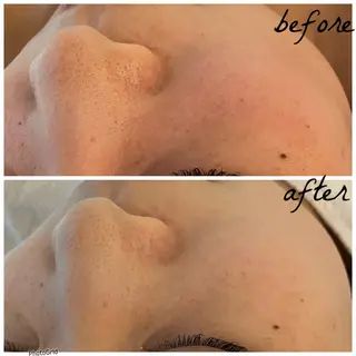 メンズ メナード岐阜市茜部 杉浦のエステ・リラクイメージ