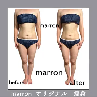 marron所属・痩身ハイパーナイフ ララピールリアボーテのエステ・リラクイメージ