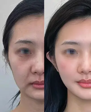 マツエク・マツパ aliaハイフ&水光ジェットサロン所属・aliaハーブ水光店 エステティシャン募集のエステ・リラクイメージ