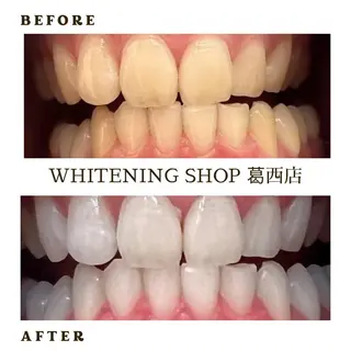 ホワイトニング ショップ葛西店のその他イメージ