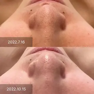 エステティックサロンPartagé【パルタージュ】所属・小尻・太もも痩せる パルタージュのエステ・リラクイメージ