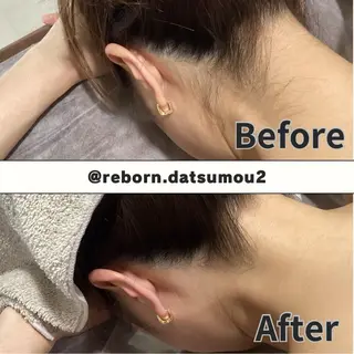 ReBORN  脱毛サロン所属・ReBORN 脱毛サロンのエステ・リラクイメージ