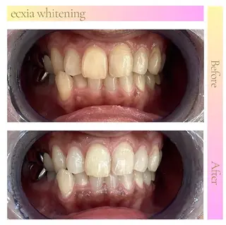 エクシアホワイトニング草津店所属・nanami -ホワイトニングのその他イメージ