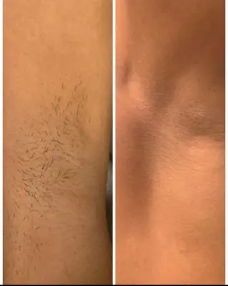 メンズ 東風平 琉登のエステ・リラクイメージ