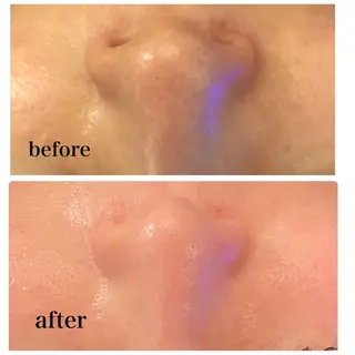 Salon de cheri サロンドシェリ人形町店所属・毛穴のお悩み・シミ 松本瞳のエステ・リラクイメージ