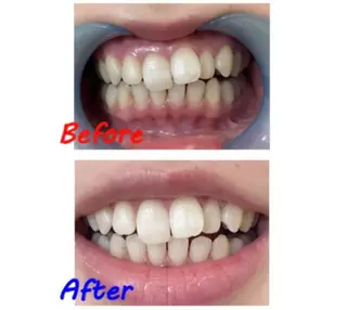 セルフホワイトニングサロン　ラヴィアン所属・ホワイトニングサロン La vie enのその他イメージ