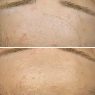 韓国🇰🇷価格 サロン_Nbibiのエステ・リラクイメージ