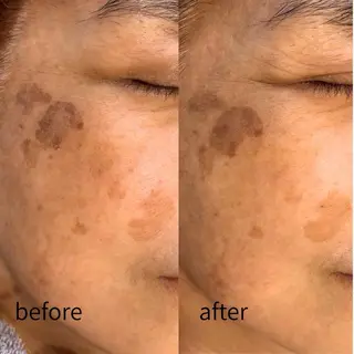 AIMER所属・AIMER アイブロウ／エステのネイルデザイン