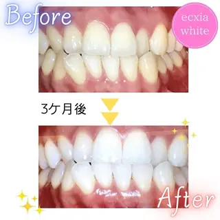 セルフホワイトニング エクシア五反田店のその他イメージ