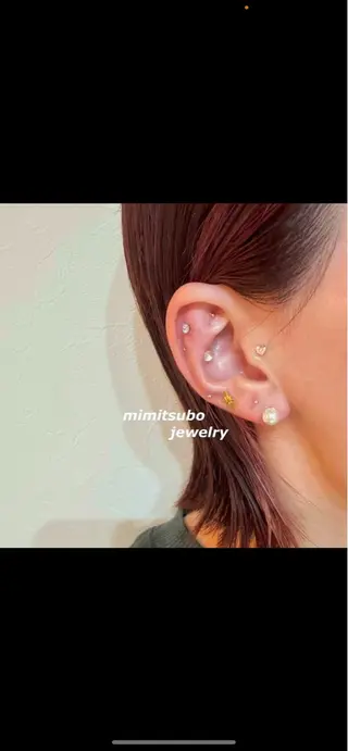 エステサロン-mignon-所属・mignon 脱毛/ ローマピンク/耳ツボのその他イメージ