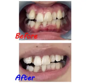 セルフホワイトニングサロン　ラヴィアン所属・ホワイトニングサロン La vie enのその他イメージ