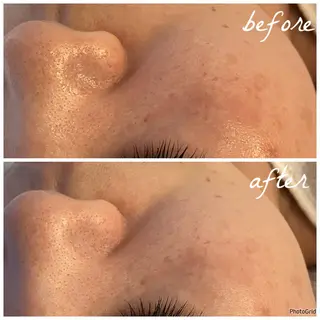 メンズ メナード岐阜市茜部 杉浦のエステ・リラクイメージ