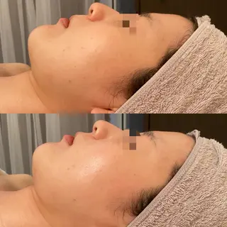 田中For..天王寺 肌質改善/よもぎ蒸しのエステ・リラクイメージ