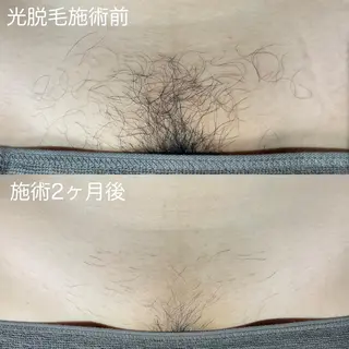 メンズ a laise 斉藤（表参道）のエステ・リラクイメージ