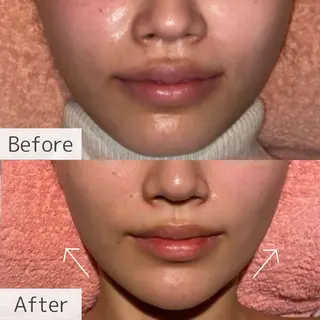 Beauty Salon LI'Aのエステ・リラクイメージ