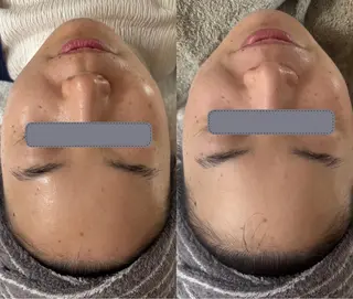 デアイム東広島所属・中井 小春のエステ・リラクイメージ