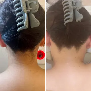 うなじ脱毛/美肌脱毛 LABELのエステ・リラクイメージ