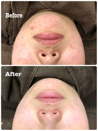 肌質改善サロン La Divinaのエステ・リラクイメージ