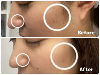 ANABEL+所属・せと ななほ🫧のエステ・リラクイメージ