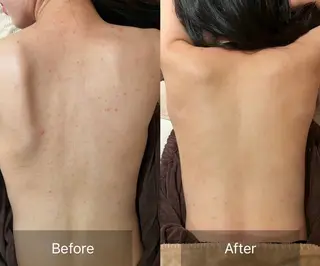 for woman所属・森 美優のエステ・リラクイメージ